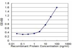 NOLC1 Antibody (3F8), Novus Biologicals 0.1 mg | Buy Online | Novus Biologicals | Fisher Scientific