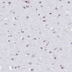NOP56 Antibody, Novus Biologicals 0.1 mL | Buy Online | Novus Biologicals | Fisher Scientific