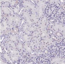 NOP56 Antibody, Novus Biologicals 0.1 mL | Buy Online | Novus Biologicals | Fisher Scientific