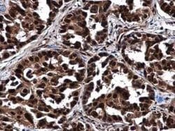 NOP56 Antibody, Novus Biologicals 100 &mu;g; Unconjugated:Antibodies, Polyclonal
