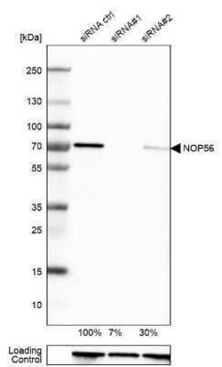 NOP56 Antibody, Novus Biologicals 0.1 mL | Buy Online | Novus Biologicals | Fisher Scientific