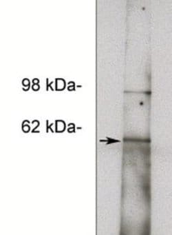 NOTUM Antibody, Novus Biologicals 100 &mu;g | Buy Online | Novus Biologicals | Fisher Scientific