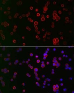 NOX1 Antibody - Azide and BSA Free, Novus Biologicals 0.1 mL; Unconjugated:Antibodies,