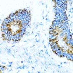 NOX1 Antibody - Azide and BSA Free, Novus Biologicals:Antibodies:Primary