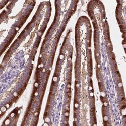 NOXO1 Antibody, Novus Biologicals 25 &mu;L | Buy Online | Novus Biologicals | Fisher Scientific