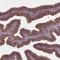 NPAL2 Antibody, Novus Biologicals:Antibodies:Primary Antibodies