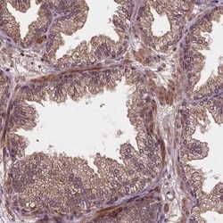 NPAL2 Antibody, Novus Biologicals:Antibodies:Primary Antibodies