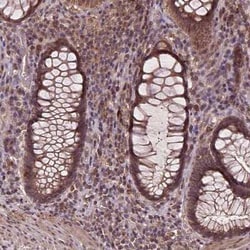 NPAL2 Antibody, Novus Biologicals:Antibodies:Primary Antibodies