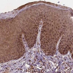NPAL2 Antibody, Novus Biologicals:Antibodies:Primary Antibodies