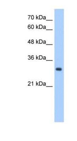 NPDC-1 Antibody, Novus Biologicals 100 &mu;L | Buy Online | Novus Biologicals | Fisher Scientific