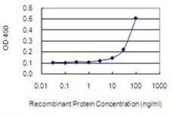 NPHP3 Antibody (3B1), Novus Biologicals 0.1 mg, Unconjugated:Antibodies,