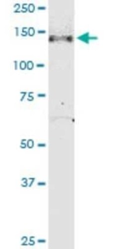 NPHP3 Antibody (3B1), Novus Biologicals 0.1 mg, Unconjugated:Antibodies,