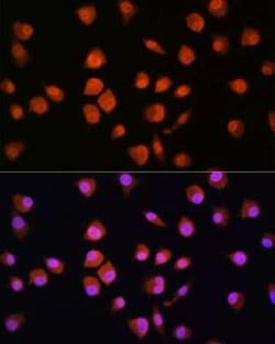 NPLOC4 Antibody - BSA Free, Novus Biologicals 0.1 mL; Unconjugated:Antibodies,