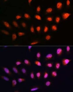 NPLOC4 Antibody - BSA Free, Novus Biologicals 0.1 mL; Unconjugated:Antibodies,
