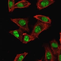 NPM1 Antibody (NPM1/1902) - Azide and BSA Free, Novus Biologicals 100 ug;