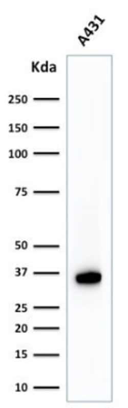 NPM1 Antibody (NPM1/1902) - Azide and BSA Free, Novus Biologicals 100 ug;