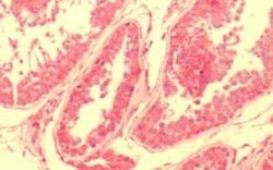 NPY2R Antibody, Novus Biologicals 50 &mu;g; Unconjugated:Antibodies, Polyclonal