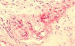 NPY2R Antibody, Novus Biologicals 50 &mu;g; Unconjugated:Antibodies, Polyclonal