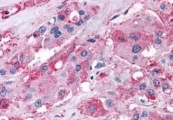 NPY5R Antibody, Novus Biologicals 50 &mu;g; Unconjugated:Antibodies, Polyclonal
