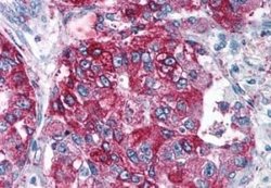 NPY5R Antibody, Novus Biologicals 50 &mu;g; Unconjugated:Antibodies, Polyclonal