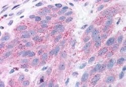 NPY5R Antibody, Novus Biologicals 50 &mu;g; Unconjugated:Antibodies, Polyclonal