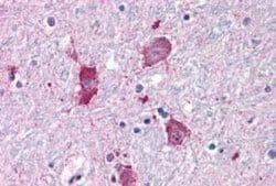 NPY5R Antibody, Novus Biologicals 50 &mu;g; Unconjugated:Antibodies, Polyclonal