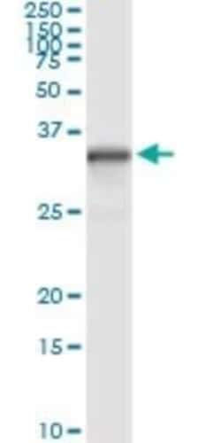 NQO-1 Antibody (1E3-A6), Novus Biologicals 0.1 mg, Unconjugated:Antikörper