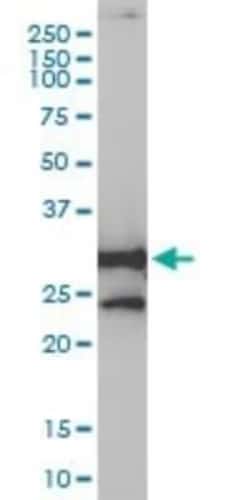 NQO-1 Antibody (1E3-A6), Novus Biologicals 0.1 mg, Unconjugated:Antikörper