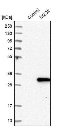 NQO-2 Antibody, Novus Biologicals 0.1 mL | Buy Online | Novus Biologicals | Fisher Scientific
