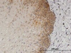 Novus Biologicals NRAGE/MAGED1 Antibody (1E1), Novus Biologicals 0.1 mg | Buy Online | Novus Biologicals&trade; | Fisher Scientific