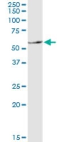 NRAMP1/SLC11A1 Antibody (2G2), Novus Biologicals 0.1 mg | Buy Online | Novus Biologicals | Fisher Scientific