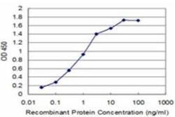 NRAMP2/SLC11A2/DMT1 Antibody (2F11), Novus Biologicals 0.1 mg | Buy Online | Novus Biologicals | Fisher Scientific
