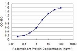 Novus Biologicals NRAMP2/SLC11A2/DMT1 Antibody (2F7), Novus Biologicals