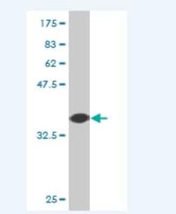 NRBP2 Antibody (2D5), Novus Biologicals 0.1 mg; Unconjugated:Antibodies,