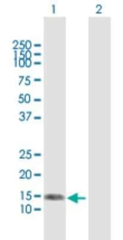 NRG4 Antibody, Novus Biologicals 0.05 mg; Unconjugated:Antibodies, Polyclonal