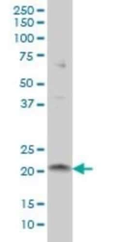 NRIF3 Antibody (3F6), Novus Biologicals 0.1 mg | Buy Online | Novus Biologicals | Fisher Scientific