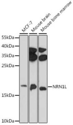 NRN1L Antibody - Azide and BSA Free, Novus Biologicals:Antibodies:Primary