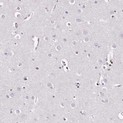 NRSF Antibody (CL0381), Novus Biologicals 0.1 mL; Unconjugated:Antibodies,