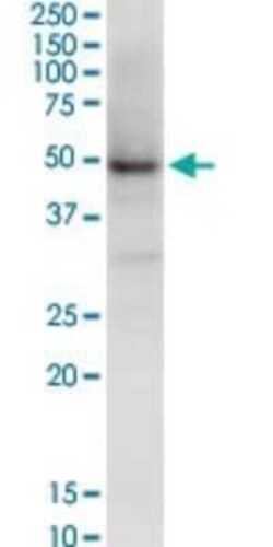 Novus Biologicals NSDHL Antibody (6E3), Novus Biologicals 0.1 mg | Buy Online | Novus Biologicals&trade; | Fisher Scientific