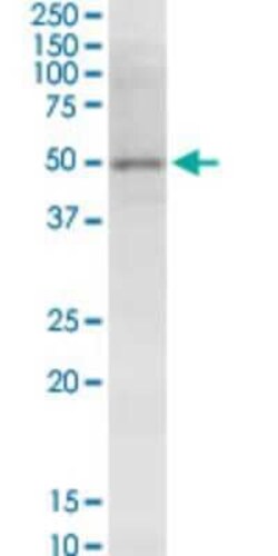 Novus Biologicals NSDHL Antibody (6E3), Novus Biologicals 0.1 mg | Buy Online | Novus Biologicals&trade; | Fisher Scientific
