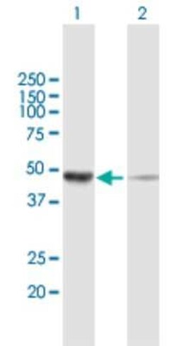 Novus Biologicals NSFL1C Antibody, Novus Biologicals 0.05 mg | Buy Online | Novus Biologicals&trade; | Fisher Scientific