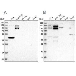 NSP 5 alpha 3 alpha Antibody, Novus Biologicals 0.1 mL; Unconjugated:Antikörper