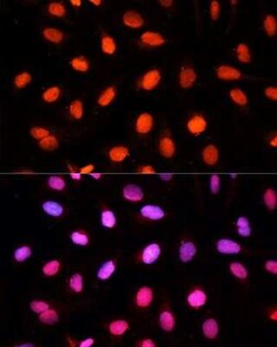 NSUN2 Antibody - BSA Free, Novus Biologicals 0.1 mL; Unconjugated:Antibodies,