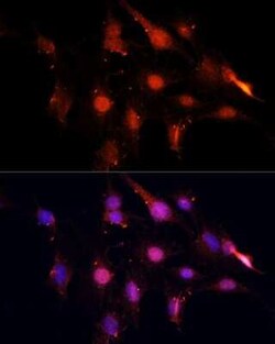 NSUN2 Antibody - BSA Free, Novus Biologicals 0.1 mL; Unconjugated:Antibodies,
