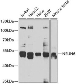 NSUN6 Antibody - BSA Free, Novus Biologicals 0.1 mL, Unconjugated:Antibodies,