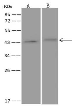 NT5C1A Antibody, Novus Biologicals 50 &mu;g; Unconjugated:Antibodies, Polyclonal