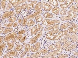 NT5C3 Antibody, Novus Biologicals 50 &mu;g, Unconjugated:Antibodies, Polyclonal