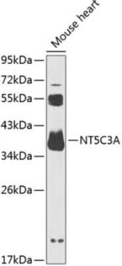 NT5C3 Antibody - BSA Free, Novus Biologicals 0.02 mL; Unconjugated:Antibodies,