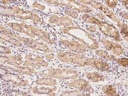 NTF2 Antibody, Novus Biologicals 100 &mu;g | Buy Online | Novus Biologicals | Fisher Scientific
