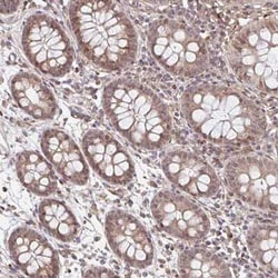 NUB1/NYREN18 Antibody, Novus Biologicals:Antibodies:Primary Antibodies